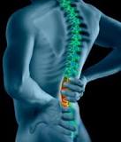 Back Pain See through image. Get the help you need now. It doesn't really get better on its own.